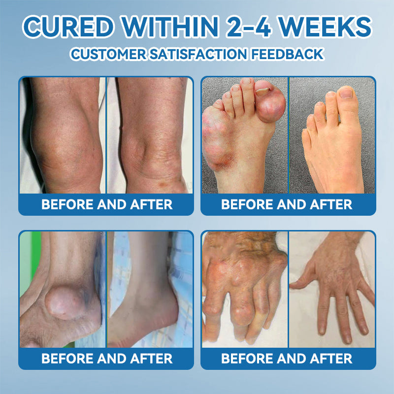 🇦🇺❤️❤️𝐟𝐥𝐲𝐬𝐦𝐮𝐬® 𝐁𝐏𝐂-𝟏𝟓𝟕 𝐉𝐨𝐢𝐧𝐭 𝐇𝐞𝐚𝐥𝐢𝐧𝐠 𝐂𝐫𝐞𝐚𝐦🦴Treats Arthritis, Neuropathy, Rheumatism, Sports Injuries & More🏆