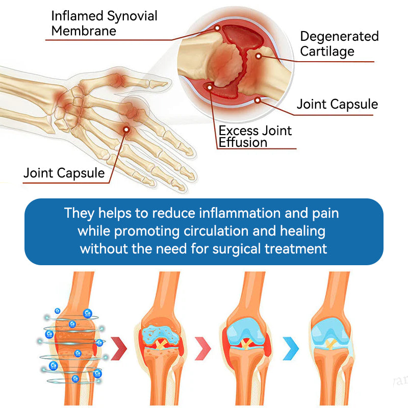 🇦🇺❤️❤️𝐟𝐥𝐲𝐬𝐦𝐮𝐬® 𝐁𝐏𝐂-𝟏𝟓𝟕 𝐉𝐨𝐢𝐧𝐭 𝐇𝐞𝐚𝐥𝐢𝐧𝐠 𝐂𝐫𝐞𝐚𝐦🦴Treats Arthritis, Neuropathy, Rheumatism, Sports Injuries & More🏆