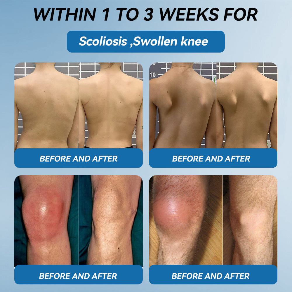 🇦🇺❤️❤️𝐟𝐥𝐲𝐬𝐦𝐮𝐬® 𝐁𝐏𝐂-𝟏𝟓𝟕 𝐉𝐨𝐢𝐧𝐭 𝐇𝐞𝐚𝐥𝐢𝐧𝐠 𝐂𝐫𝐞𝐚𝐦🦴Treats Arthritis, Neuropathy, Rheumatism, Sports Injuries & More🏆