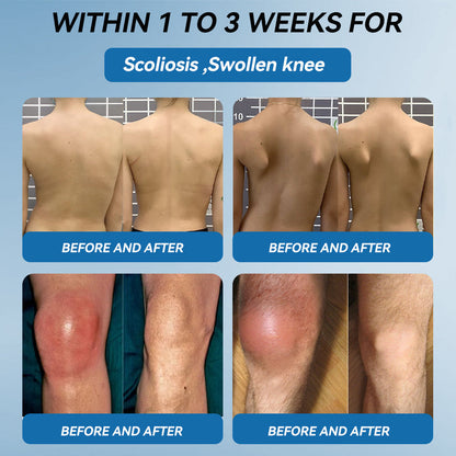 🇦🇺❤️❤️𝐟𝐥𝐲𝐬𝐦𝐮𝐬® 𝐁𝐏𝐂-𝟏𝟓𝟕 𝐉𝐨𝐢𝐧𝐭 𝐇𝐞𝐚𝐥𝐢𝐧𝐠 𝐂𝐫𝐞𝐚𝐦🦴Treats Arthritis, Neuropathy, Rheumatism, Sports Injuries & More🏆