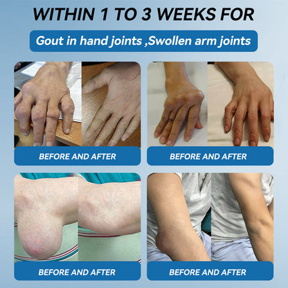 🇦🇺❤️❤️𝐟𝐥𝐲𝐬𝐦𝐮𝐬® 𝐁𝐏𝐂-𝟏𝟓𝟕 𝐉𝐨𝐢𝐧𝐭 𝐇𝐞𝐚𝐥𝐢𝐧𝐠 𝐂𝐫𝐞𝐚𝐦🦴Treats Arthritis, Neuropathy, Rheumatism, Sports Injuries & More🏆