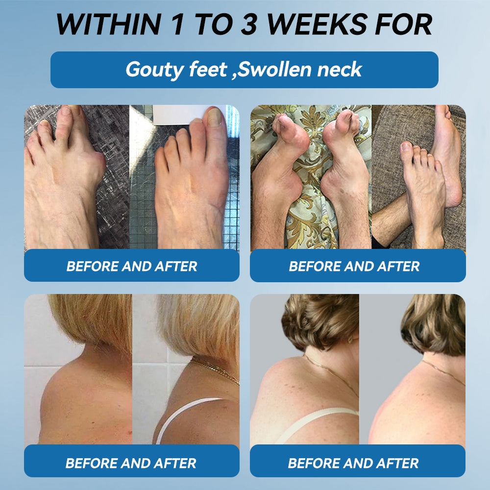 🇦🇺❤️❤️𝐟𝐥𝐲𝐬𝐦𝐮𝐬® 𝐁𝐏𝐂-𝟏𝟓𝟕 𝐉𝐨𝐢𝐧𝐭 𝐇𝐞𝐚𝐥𝐢𝐧𝐠 𝐂𝐫𝐞𝐚𝐦🦴Treats Arthritis, Neuropathy, Rheumatism, Sports Injuries & More🏆