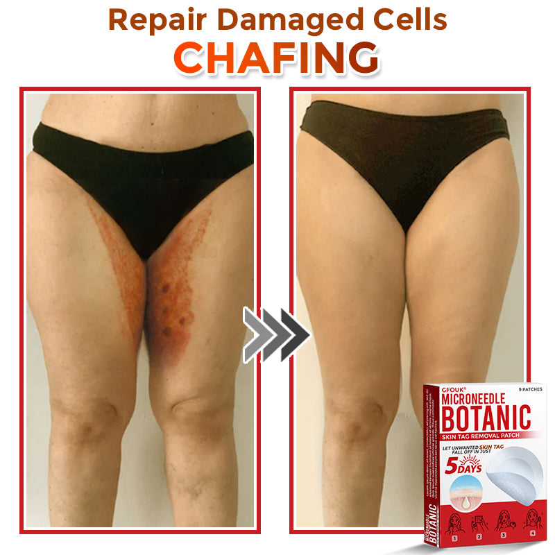 🇦🇺𝐆𝐅𝐎𝐔𝐊® 𝐌𝐢𝐜𝐫𝐨𝐍𝐞𝐞𝐝𝐥𝐞 𝐁𝐨𝐭𝐚𝐧𝐢𝐜 𝐒𝐤𝐢𝐧 𝐓𝐚𝐠 𝐑𝐞𝐦𝐨𝐯𝐚𝐥 Patch