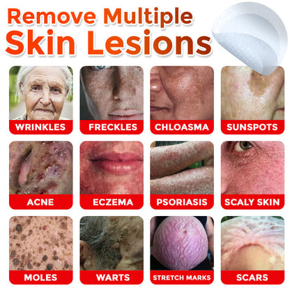 🇦🇺𝐆𝐅𝐎𝐔𝐊® 𝐌𝐢𝐜𝐫𝐨𝐍𝐞𝐞𝐝𝐥𝐞 𝐁𝐨𝐭𝐚𝐧𝐢𝐜 𝐒𝐤𝐢𝐧 𝐓𝐚𝐠 𝐑𝐞𝐦𝐨𝐯𝐚𝐥 Patch